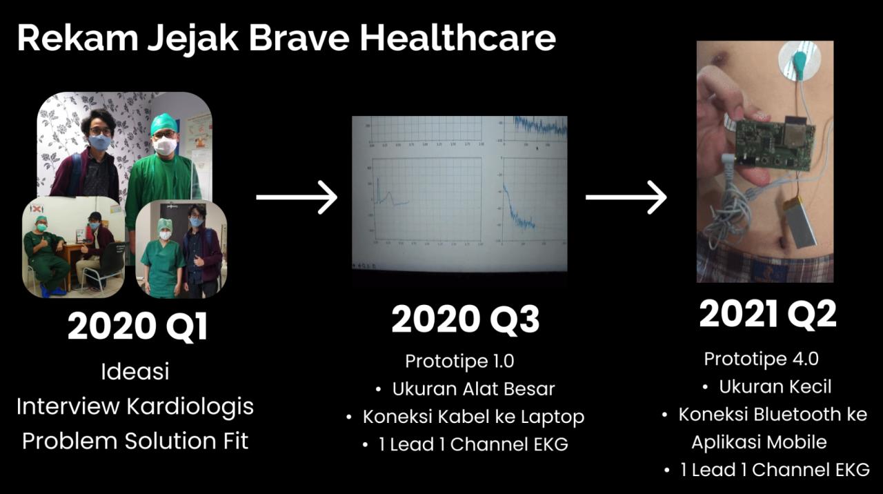 Holter (EKG) prototype and data capture system on mobile